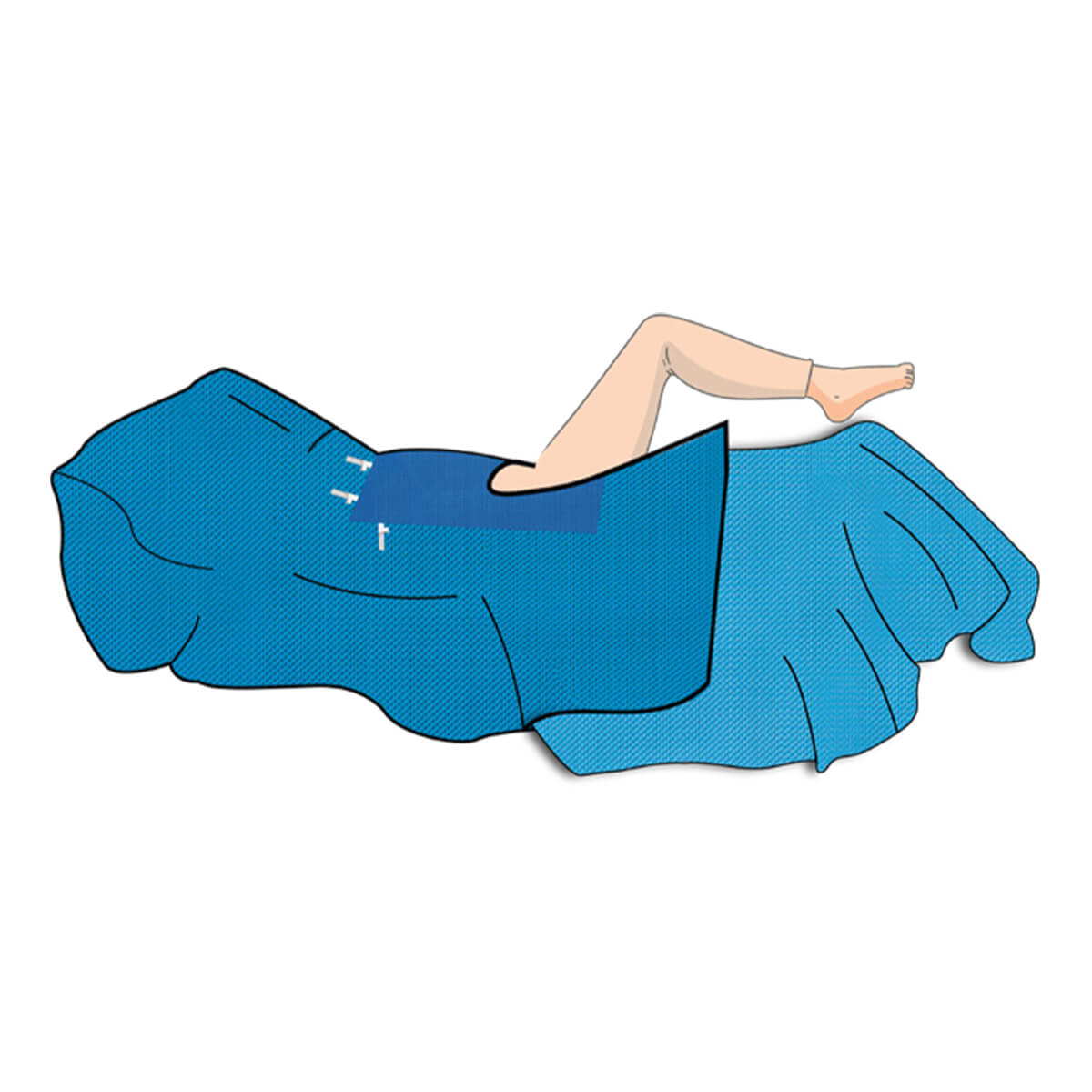 Paquete para cirugía universal II